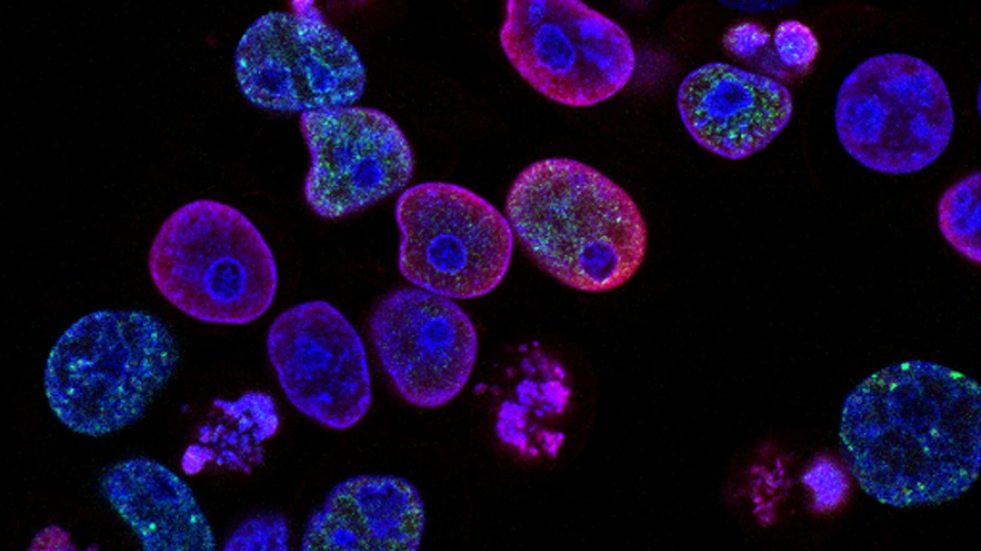 Kmenovými buňkami proti superrezistentním bakteriím
