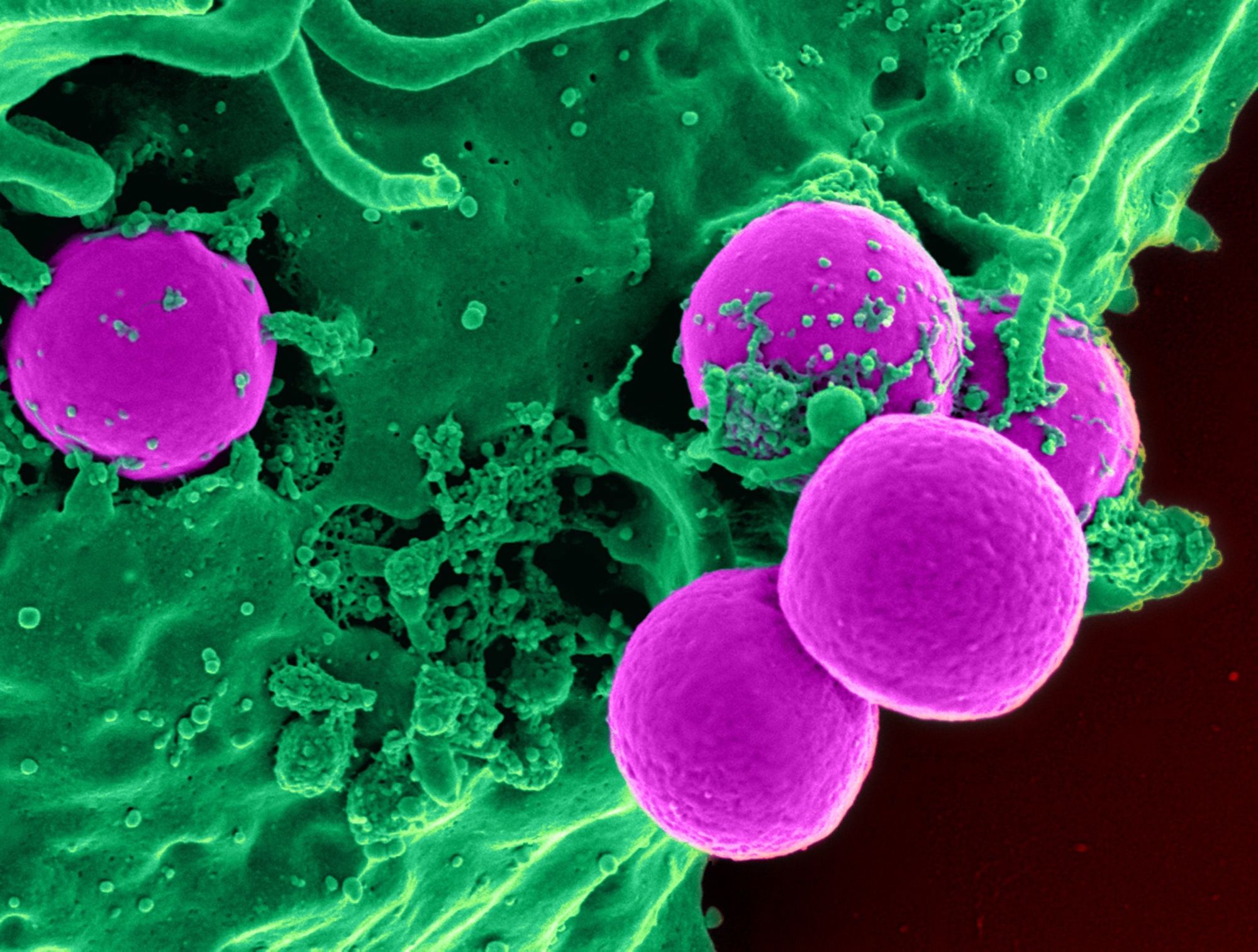 Boreliózu by mohlo účinněji léčit zapomenuté antibiotikum
